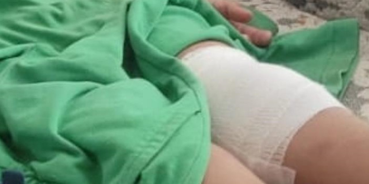 Bursa’da sokak köpeği saldırısına uğrayan çocuk hastaneye kaldırıldı