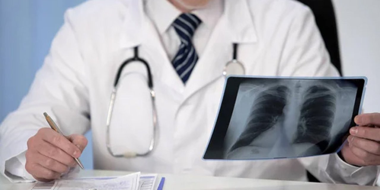 Uzmanlar düşük doz tomografi çağrısı yaptı: “Mutlaka yaptırın”