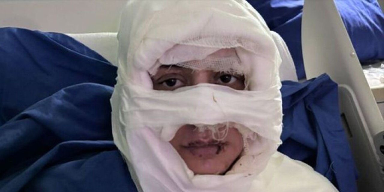 Kadıköy’de korkunç saldırı: Genç kadını kolonyayla yaktı, şüpheli tutuklandı