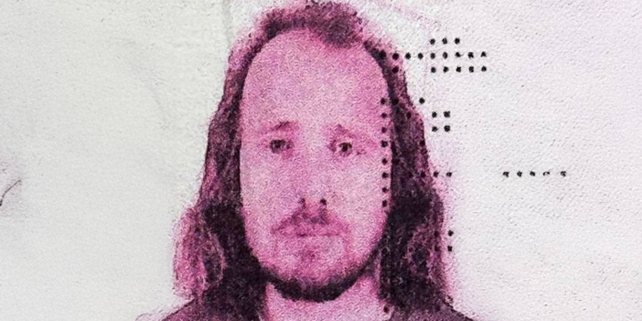 İstanbul’da saç ve diş operasyonu ölümle sonuçlandı!