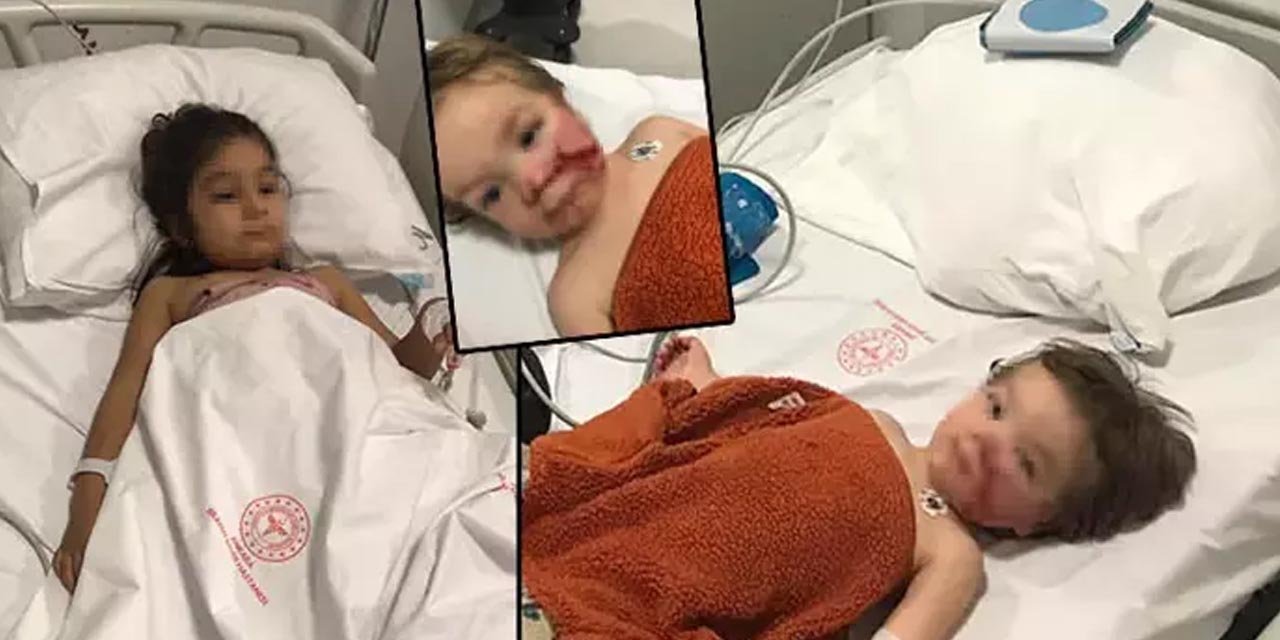 Ankara’daki dehşet aydınlanıyor: 2 çocuğa saldıran pitbull ve sahibi yakalandı