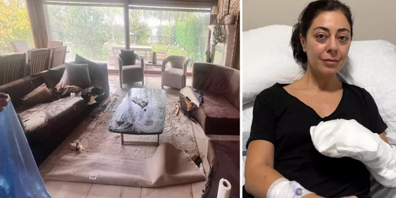 Dekoratif Şömine Faciaya Döndü: “Alev Alev Yandım, Sakın Almayın!”