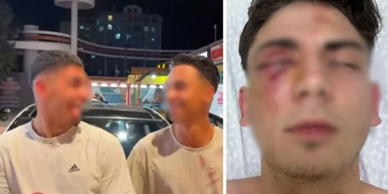 Muştalarla döverek kör ettiler, ellerinde kan ile video çektiler!