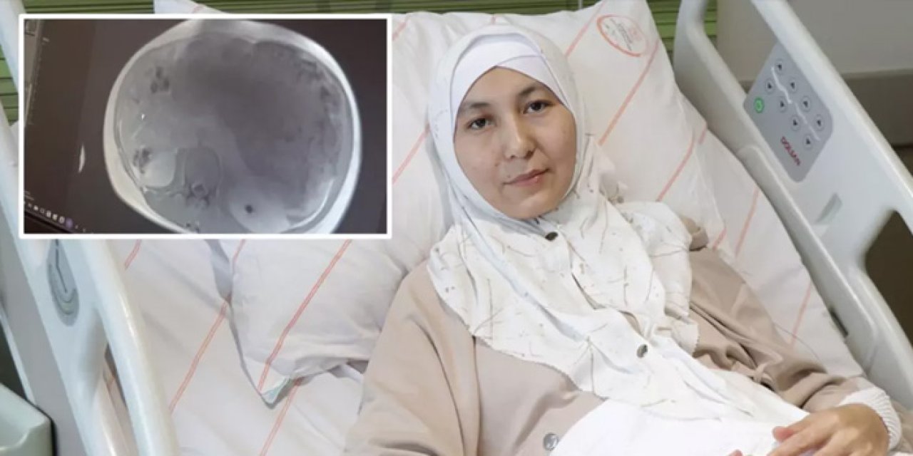 Hamile Sandılar, İçinden 45 Santimetrelik Tümör Çıktı!