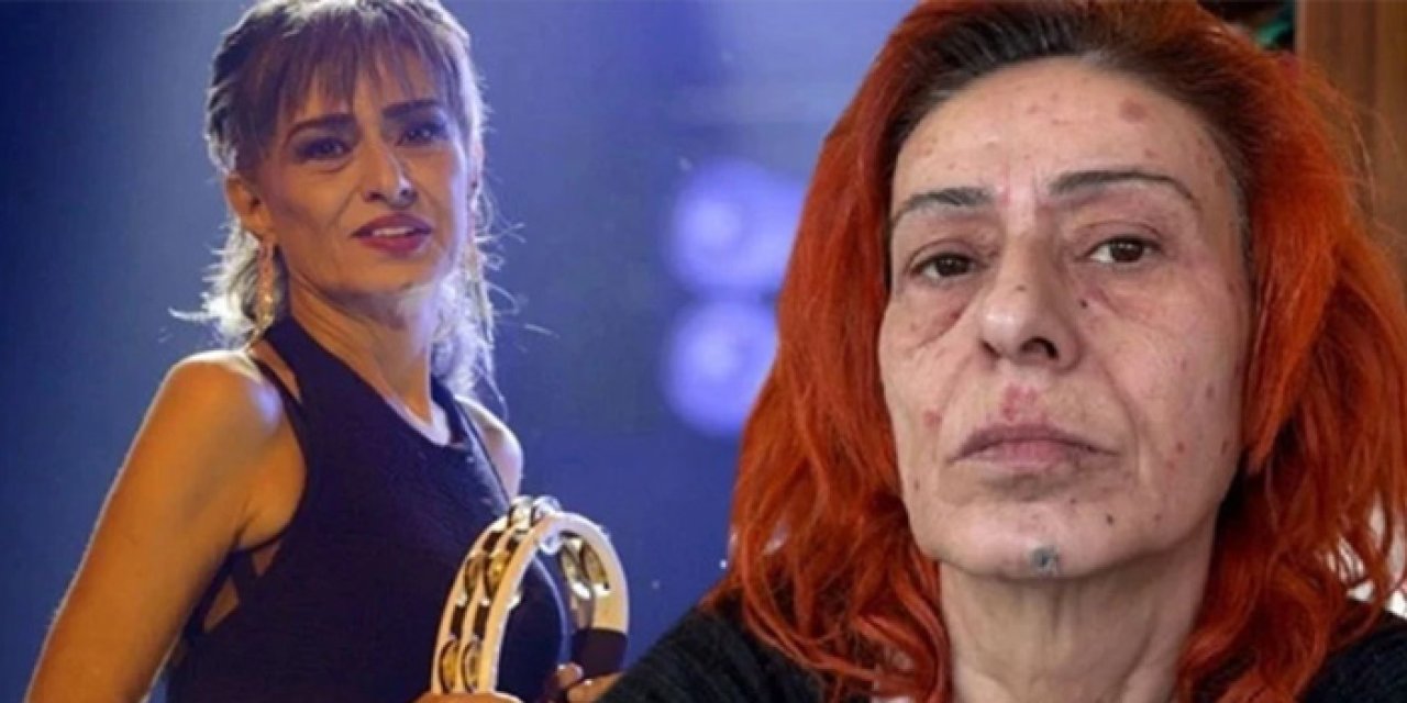 Yıldız Tilbe hastaneye mi kaldırıldı? Yıldız Tilbe sağlık durumu nasıl?