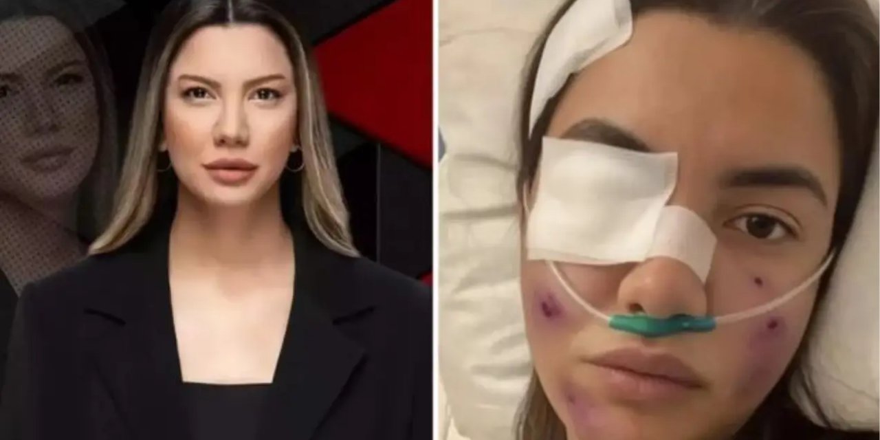 Fulya Öztürk kaza mı yaptı? Fulya Öztürk Yaşıyor mu? Fulya Öztürk sağlık durumu?