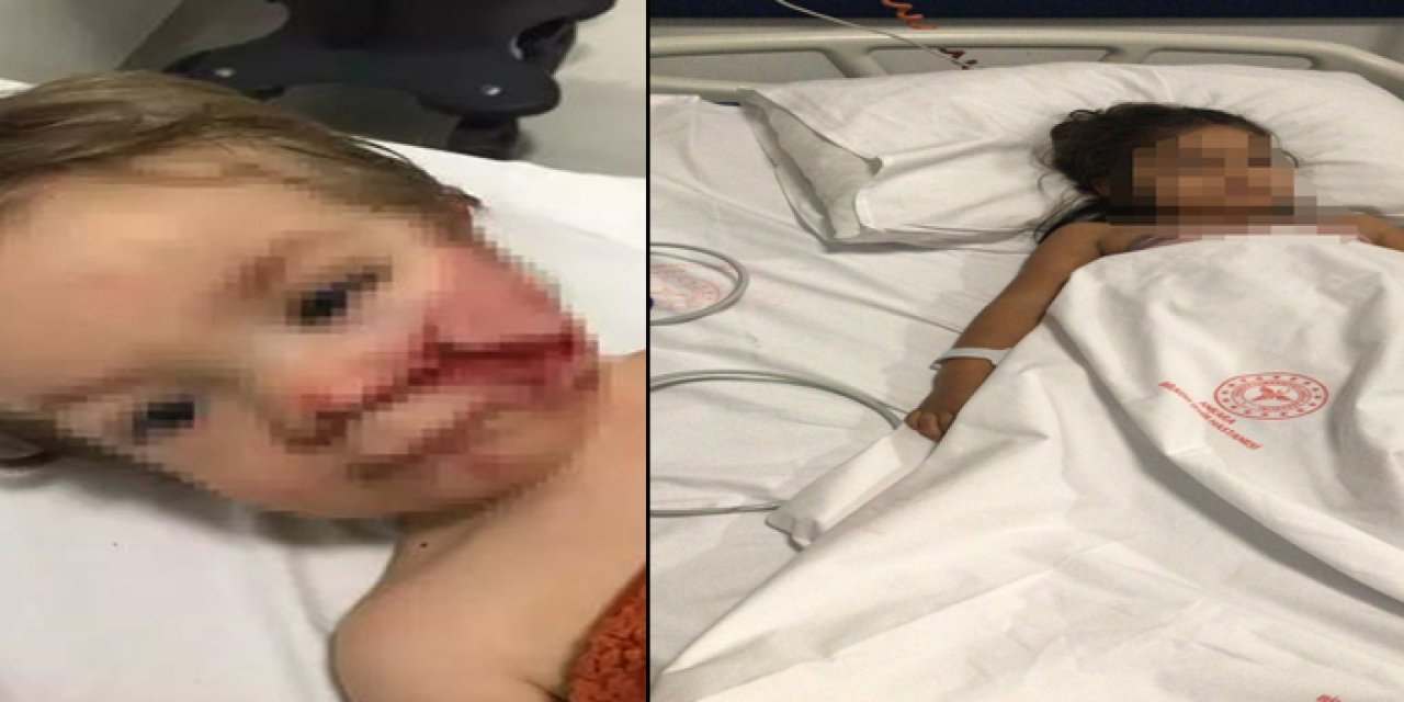 Ankara’da pitbull saldırısı davası başladı