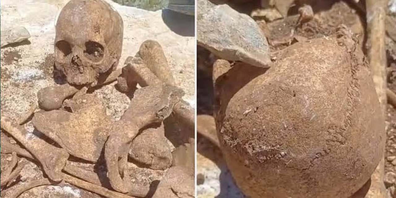 Malatya'da inşaat kazısında insan kemikleri bulundu