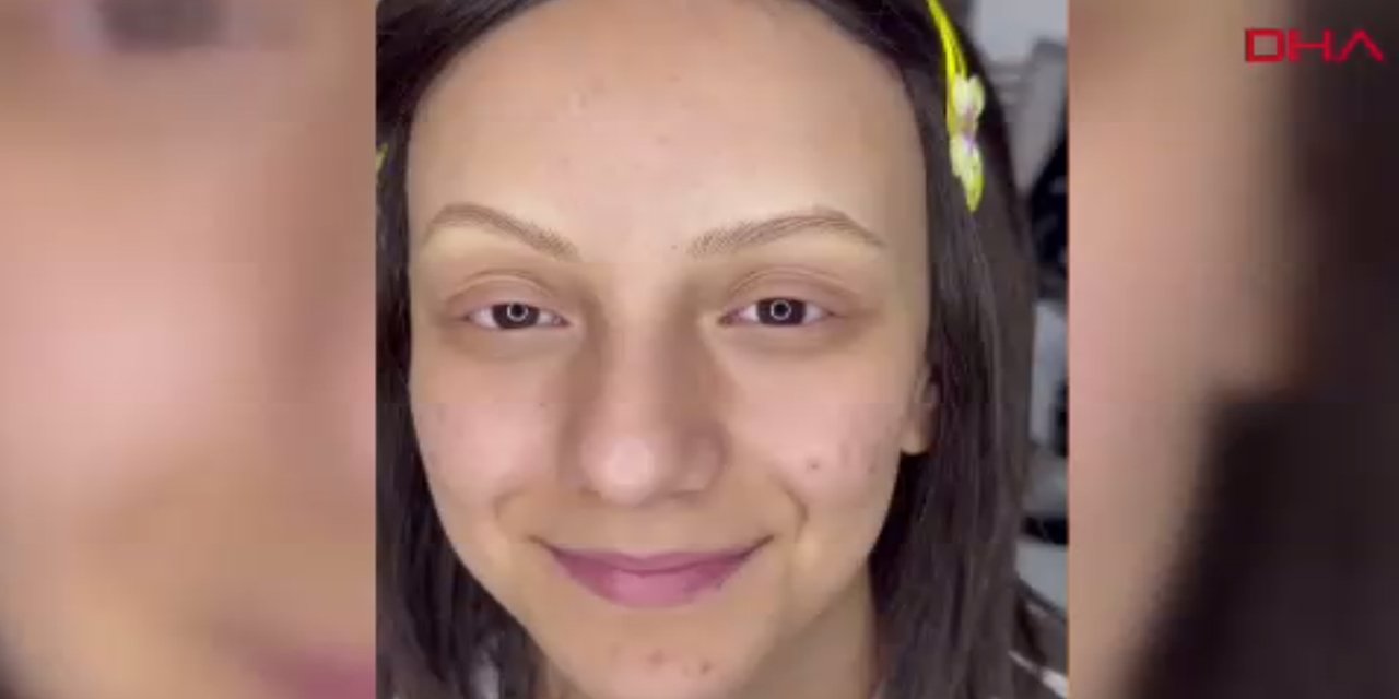 Alopesi hastası Esma Nur'un 'kaş' hayali gerçek oldu