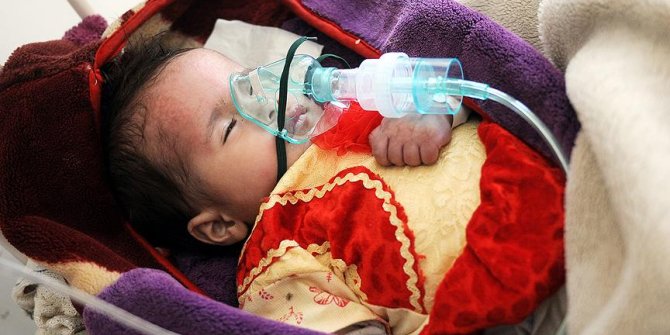 Yemen'de kolera can almaya devam ediyor