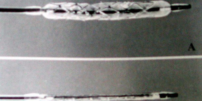 Koroner kalp hastalığına mikro stent geliştirildi