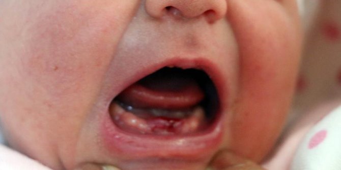 Bebeğin ağzını gören doktorlar gözlerine inanamadı!