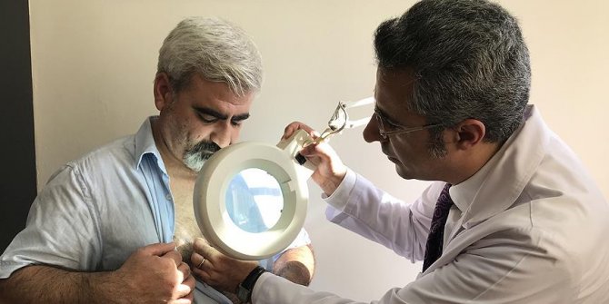 Bir sivilceyle başlayan hastalığıyla 12 yıldır mücadele ediyor