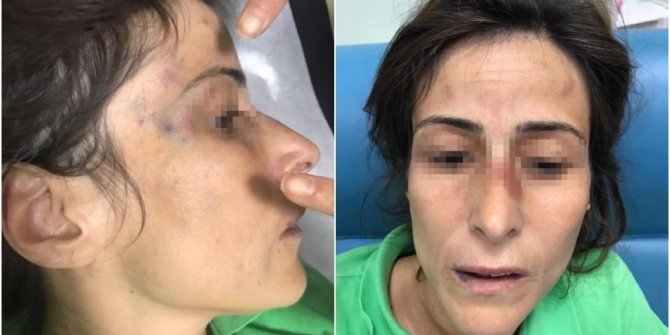 Eşini darbederek kemiklerini kıran doktora hapis cezası