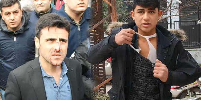 Seyyar satıcı, zabıtanın burnunu kırdı