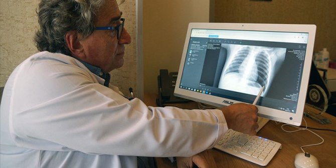 Grip sanılan çocuğun akciğerinden fıstık çıktı
