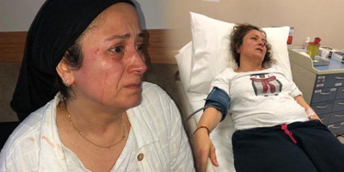 Hayvansever kadından, 'Sokaklarda köpekleri besliyorum diye dövdüler' iddiası