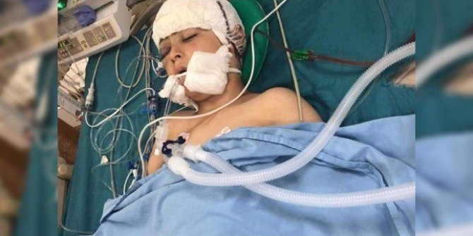 İsrail askeri, 9 yaşındaki Filistinli çocuğu başından vurdu
