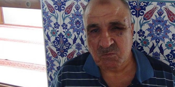 Engelli imamı dövdüler
