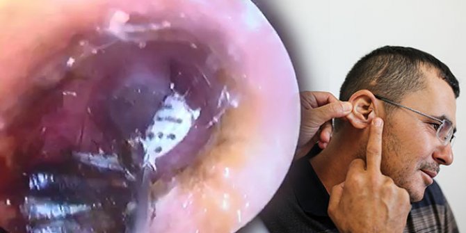 Antalya'da akılalmaz olay! Kulağındakini görünce gözlerine inanamadı