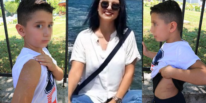Küçük çocuğa 'işkence' ve 'ihmal' soruşturmasında yeni gelişme