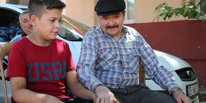 'Balık pulu' hastası 150 kişi rahatça dışarı çıkmak istiyor