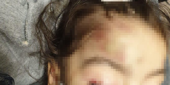 Adana'da üvey anne dehşeti