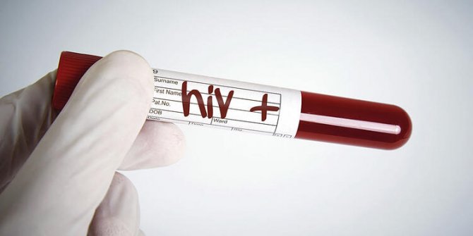 Yeni HIV türü keşfedildi