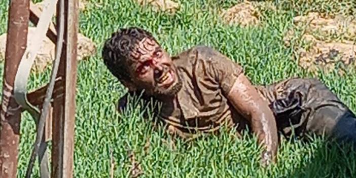 O ilimizde panik! Yabancı uyruklu kuduz hastası hastaneden kaçtı