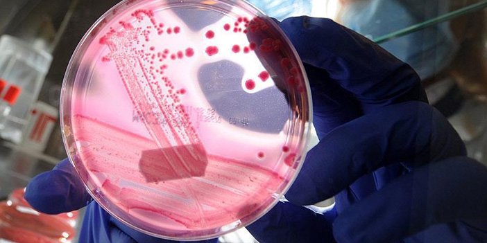 kanser evresi nasıl tespit edilir