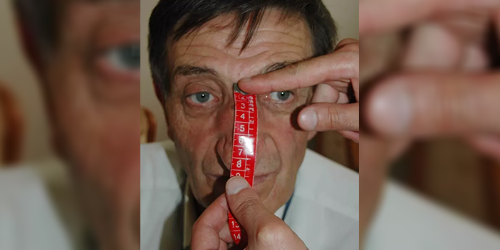 mehmet özyürek burun